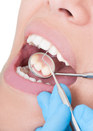 Woman at a Dentist
